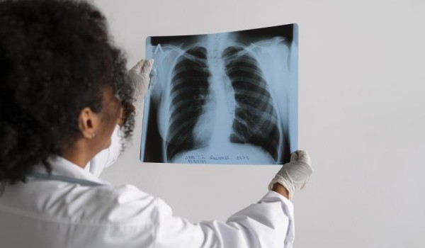 Doenças pneumocócicas – disponíveis na rede privada