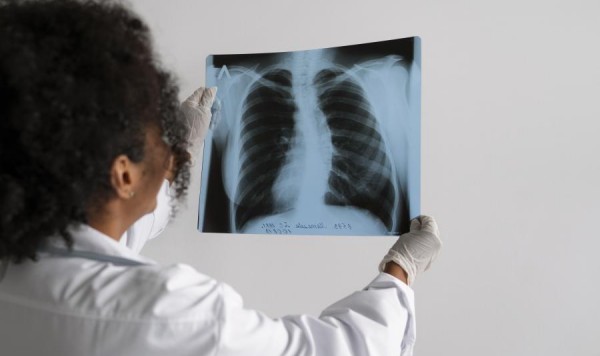 Doenças pneumocócicas – disponíveis na rede privada